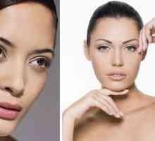 10 Načinov, kako odstraniti brazgotine in akne brazgotine na obrazu