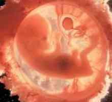 Porodniška 12 tednu nosečnosti