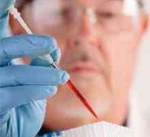 Krvni test za otroke - prepis