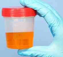 Analiza urina pri otrocih