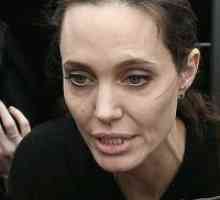 Angelina Jolie v bolnišnico