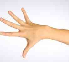Artritis prstov