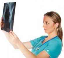 Osteoartritisa kolka - Simptomi