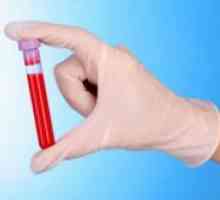 Analiza ast krvi