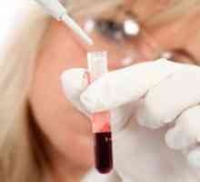Ast - stopnja žensk v krvi
