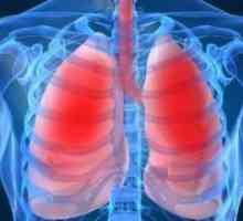 Pljučna atelectasis