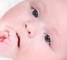Atopijski dermatitis pri dojenčkih - Zdravljenje