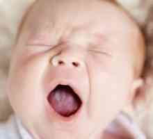Bel jezik pri dojenčkih