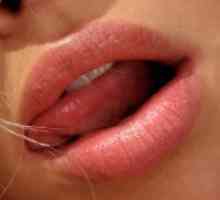 Bele lise na ustnicah