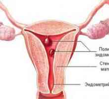 Nosečnost in endometrija polip