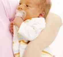 Bilirubin pri novorojenčkih