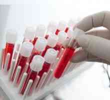 Biokemijske preiskave krvi - prepis