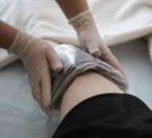 Bolečina koleno - Zdravljenje