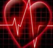 Nevaren sinusna aritmija srca?
