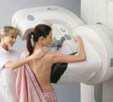 Kateri je boljši - ultrazvočno ali mamografija?