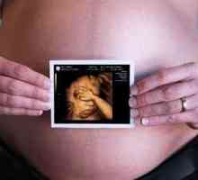 Kaj je 3D ultrazvok v nosečnosti