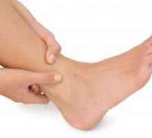Dermatitis na nogah