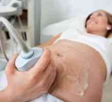 Doppler ultrazvok v nosečnosti - kaj je to?