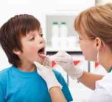 Faringitis pri otrocih - Zdravljenje