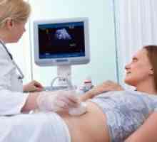 Hematom na zgodnji nosečnosti