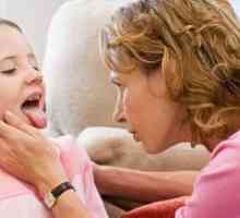 Herpes vneto grlo pri otrocih - Zdravljenje