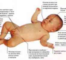 Novorojenčka zdravje