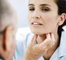 Hipertiroidizem - Zdravljenje