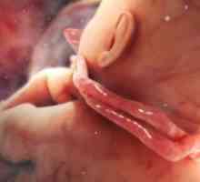 Fetalni hipoksija - simptomi