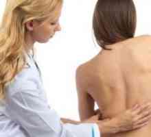 Hernija ledvene hrbtenice - Simptomi