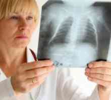 Kronična obstruktivni bronhitis