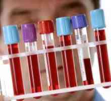 Preskus Encimski imunski test krvi