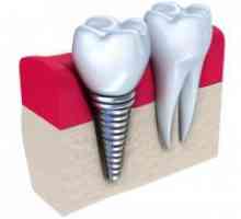 Zobni vsadki - kontraindikacije in možni zapleti
