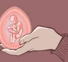 Prekinitve nosečnosti