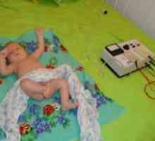 Elektroforeza za dojenčke