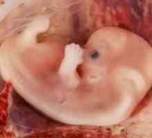 Človeški zarodek