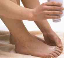 Kako se znebiti dermatofitija stopala?