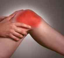 Kako za zdravljenje osteoartritisa kolena?