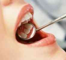 Kako za zdravljenje zobni gnilobi?