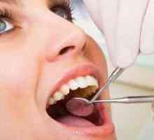 Kako za zdravljenje parodontalne bolezni?