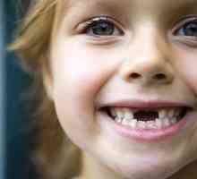 Kako spremeniti zob pri otrocih
