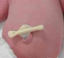 Kako ravnati popka novorojenčka s pin?