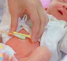 Kako ravnati popka novorojenčka