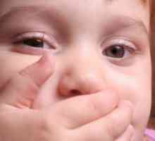 Kako je streptoderma otroci?