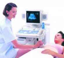 Kako je ultrazvok jajčnikov?