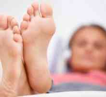 Kako za zdravljenje glivic na nogah?