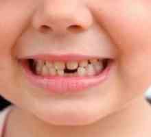 Kaj so zobje izpadejo pri otrocih?