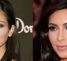 Kim Kardashian pred in po plastičnih mas