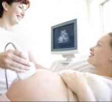 Kdaj ultrazvok v nosečnosti?