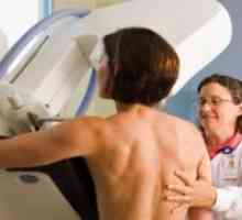 Ko je najbolje, da to mamogram?