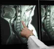 Računalniška tomografija hrbtenice